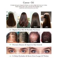 Using castor oil for curly hair will nourish your hair like never before and get the care they need. Natural Black Castor Oil Hair Growth Essential Oils Organic Eyelash Enhancer Growth Oil Hair Moisturizing Products N2 Smio