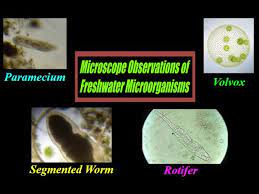 Pond water under microscope labeled. Pond Water Under Microscope Mr Pauller Youtube