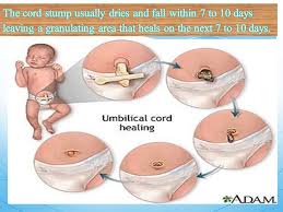 Incision care is usually vouched by the lubricant gauze provided by the doctor. The Neonatal Period The Neonatal Period Is Defined As The First 28 Days Of Life Purpose Of Immediate Newborn Care 1 To Establish Maintain And Ppt Download