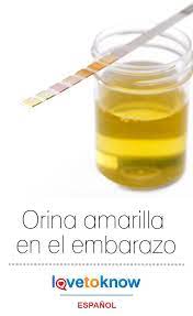 Pin En Embarazo
