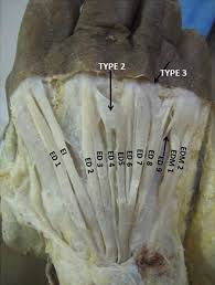 Maybe you would like to learn more about one of these? Right Hand Ei Extensor Indicis Ed Extensor Digitorum Ed 1 Single Download Scientific Diagram