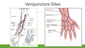 Initiating And Discontinuing Iv Infusion Ppt Video Online