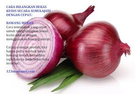 We did not find results for: 6 Cara Hilangkan Bekas Kudis Di Kaki Dengan Cepat Milkup Sdn Bhd