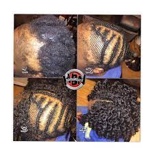 Image Result For Crochet Braids With Alopecia Braids With Alopecia Alopecia Hairstyles Braid Pattern