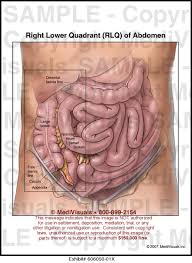 Study 4 4 quadrants of the abdomen flashcards from cody p. Medivisuals Right Lower Quadrant Rlq Of Abdomen Medical Illustration