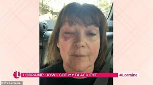 Lorraine Kelly updates fans