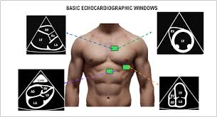 Image result for Point of Maximum Impulse