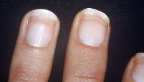 nails saying about your health