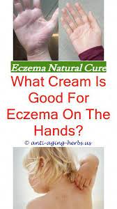 Eczema Cold Water What Does Nummular Eczema Look Like Skin Therapy For Eczema Eczema Causes Eczema Treatment Nummular Eczema