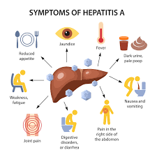 Image result for hepatitis symptoms