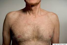 But men tend to delay going to the doctor until they. 6 Things Men Affected By Breast Cancer Want You To Know Huffpost Uk Life