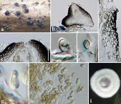 We did not find results for: Microfungi Associated With Clematis Ranunculaceae With An Integrated Approach To Delimiting Species Boundaries Springerlink