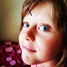 HeartShine Acupuncture