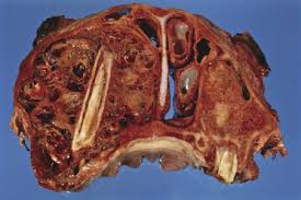 However, it's possible — and even somewhat more likely — to have chronic sinusitis. Diseases Of The Respiratory System Veterian Key