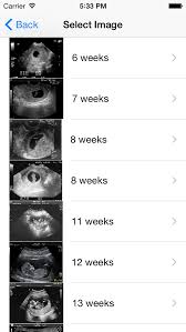 We support all android devices such as samsung, google, huawei, sony, vivo, motorola. Ultrasound Spoof Fake Free Apps 148apps