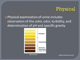 Urinalysis By Adelle Heidi Urinalysis By Adelle And Heidi