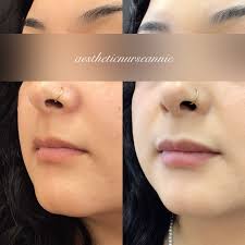 Hi! I'm Annie, an Aesthetic Registered Nurse who turned my lifelong passion  for beauty, skincare, and aesthetics into a career. I am a huge self-care  advocate, always urging my clients to invest