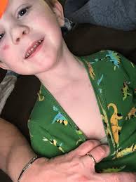 Child injured doing backflip