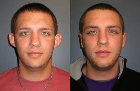 Do plastic surgeons elect to undergo cosmetic surgery more than the average american? 8 Reasons For Men To Get Plastic Surgery Treatments Dr Matthew Conrad