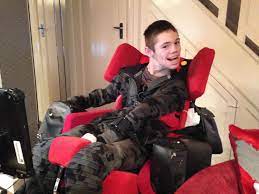 Lesch Nyhan Syndrome Causes Symptoms Treatment Life Expectancy
