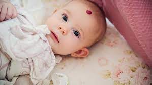 Skin cancer is the most common form of cancer. Strawberry Hemangioma Causes Concerns And Tips