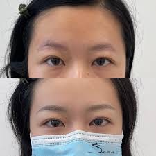 Sara Zhou (@sara_luxaesthetics) · Markham, ON