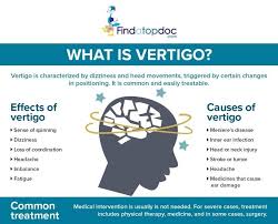 Image result for Vertigo Management