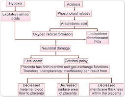 Image result for Contraction Stress Test