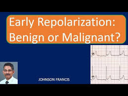Image result for Early Repolarization