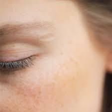 Le stress est également incriminé !, poursuit le dr ionescu. Peau Sensible Et Reactive 10 Conseils Pour L Apaiser