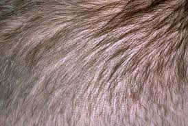 Folliculitis is often temporary but more severe cases can be difficult to treat and can cause damage to hair and scalp that leave bald patches. Causes And Treatment Of Scalp Acne