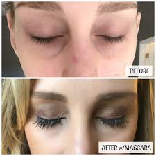 Lash boost* is only available through a rodan & fields consultant. My Rodan Fields Brightening And Lash Boost Experience