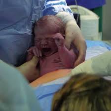 Las fuerzas que actúan en este periodo son las contracciones uterinas y la prensa abdominal de la mujer. Cesaria Horrible Debio Haber Sido Parto Normal Photos Facebook