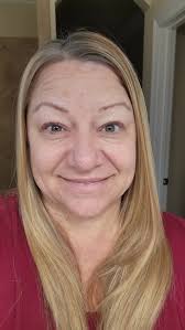 Gastric sleeve surgery day in Cleveland