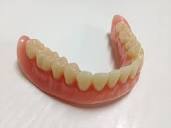 Complete (Full Dentures) | College of Dentistry | University of ...