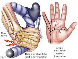 How Can I Prevent Numb Hands When Riding Cycling Numbness In Hands Cyclist