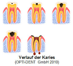 Karius und baktus von thorbjörn egner gebundene ausgabe 11,00 €. Didaktik Und Methodik Der Gesundheitsforderung Der Blog Der Kampf Gegen Karius Und Baktus Eine Unendliche Geschichte