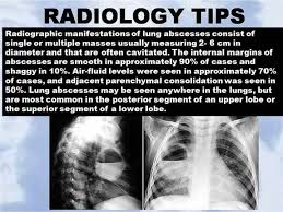 Pin By Annette Shank On Radiology Radiology Radiography Physiology