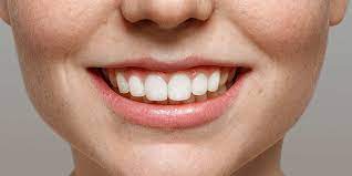 It also helps keep your bones and teeth strong. Prevent Tooth Decay Stop Teeth Damage Natural Treatments