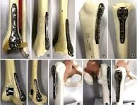 Expanding the horizons of clinical applications of proximal ...