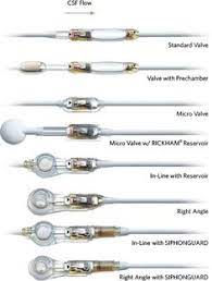 We did not find results for: 49 Hydrocephalus Ideas Brain Surgery Awareness Spina Bifida