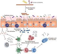 Frontiers Celiac Disease A Review Of Current Concepts In Pathogenesis Prevention And Novel Therapies Pediatrics