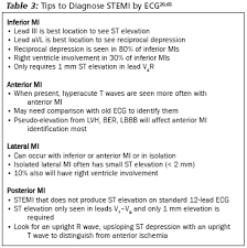 Nstemis are defined by the presence of myocardial infarction as detected by a rise in cardiac biomarkers, without ecg changes indicative of a stemi.1. Missed Myocardial Infarction Ecg Strategies To Reduce The Risk 2009 06 08 Ahc Media Continuing Medical Education Publishing