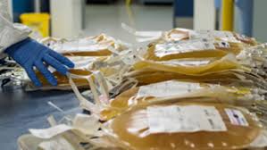 Image result for Platelet Transfusion