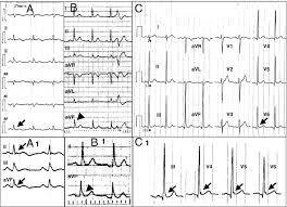 Image result for J Point