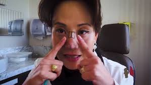 CIrurgia Plástica Sem Segredo: Frontoplastia Feminizadora