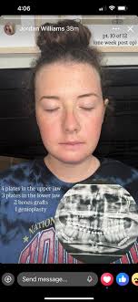 Prayers please for Andrew Bieber , and Nichole Bieber and family. They are  now in hospice care and Nichole requests prayers so she can navigate the  swift changes with his needs gracefully!