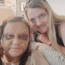 Fundraiser by Amanda Brewster : Help Billie Dye Heal from Severe Injuries