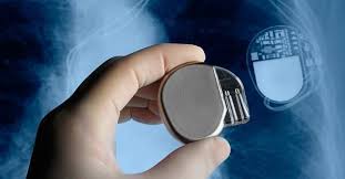 Holter ρυθμου & holter πιεσησ. Bhmatodotes Apinidwtes Arry8mies Kai 8erapeytikes Epiloges Ellhnikh Ry8mologikh Etaireia