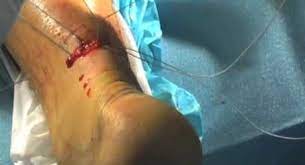 Www Surgeryassistant Nl